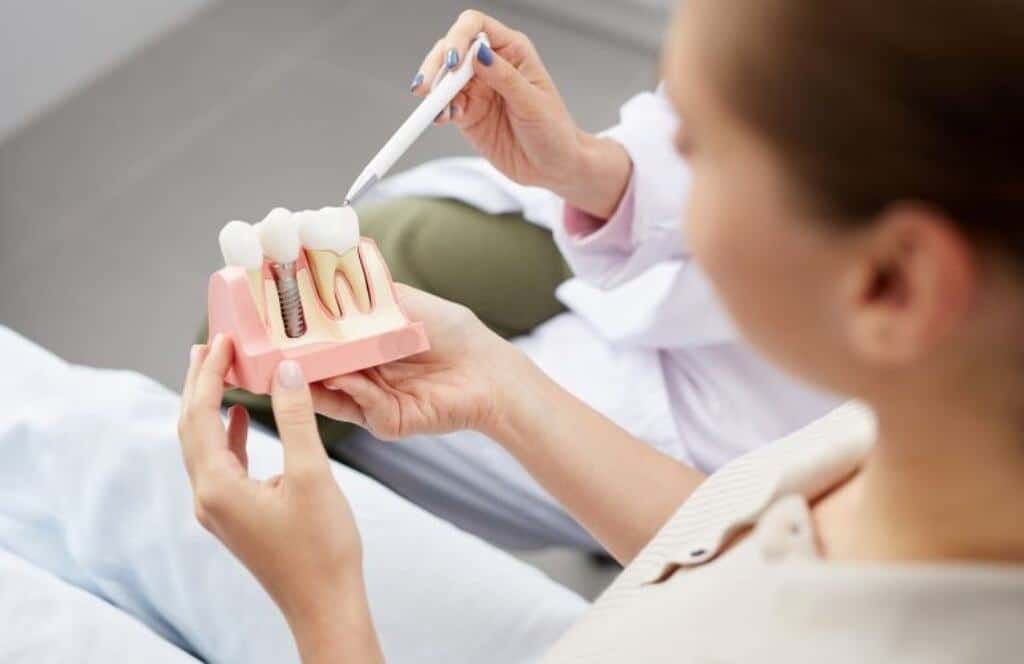 How to Find Affordable Dental Implants