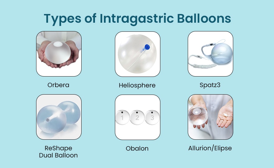 gastric balloons